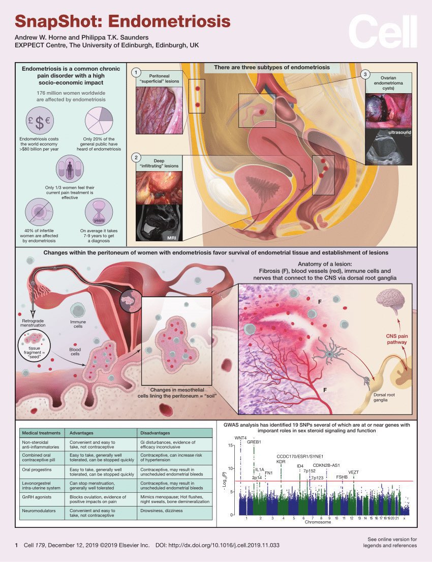 AdvReproduction's tweet image. Endometriosis

#IVF #sperm #SciComm #Research #ScienceTwitter #technology #AcademicChatter #meded #MedTwitter #Infertility #reproductivehealth #endometriosis 

Credit: @CellCellPress