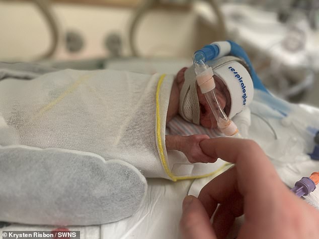 Zaylan Reed akhirnya bisa pulang setelah 180 hari dirawat di rumah sakit. Zaylan Reed lahir dengan berat badan 500 gram dan saat dilahirkan umur kehamilan si ibu baru 23 minggu. #InfoKesehatan