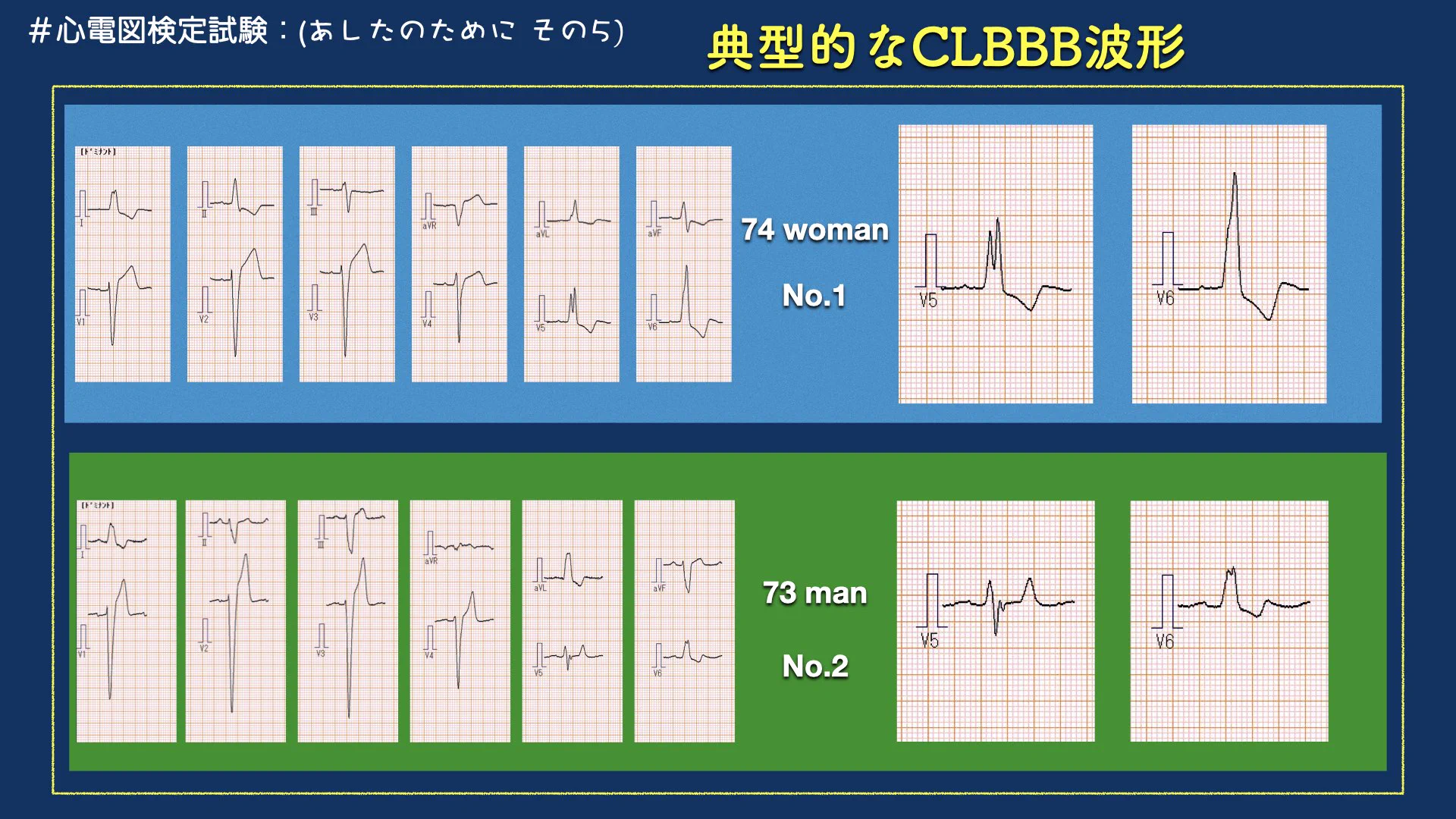 N. Tsukishima EP大学心電図検定学部試験対策科担任 on X: 