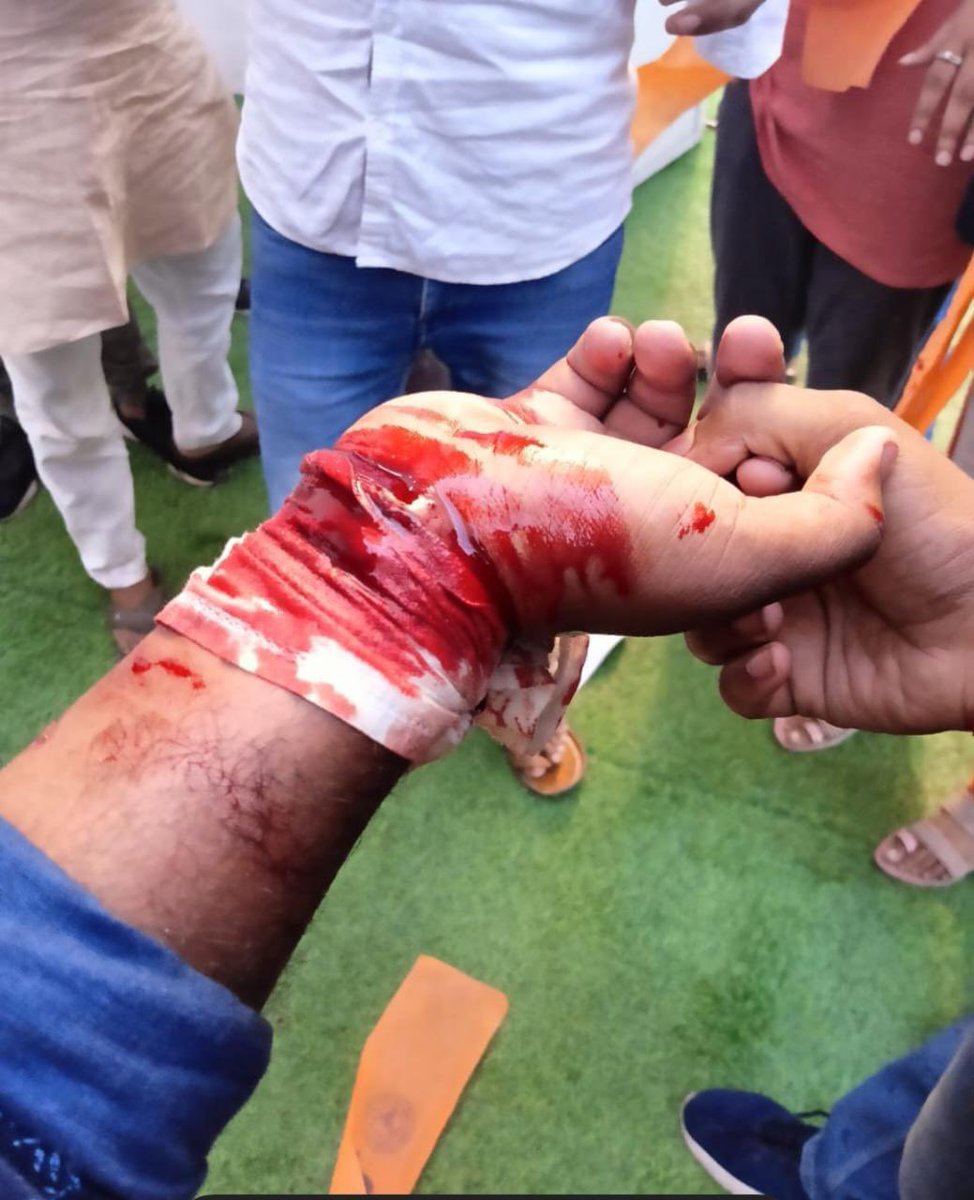 Akshay_Svar's tweet photo. #ShameOnDduguVC  
छात्र हॉस्पिटल में 
पुलिस हॉस्टल में
ये नया A+++ गोरखपुर विश्वविद्यालय है।
भ्रष्ट कुलपति मुर्दाबाद!
#DDU #ABVP https://t.co/p3QMOlDrBP