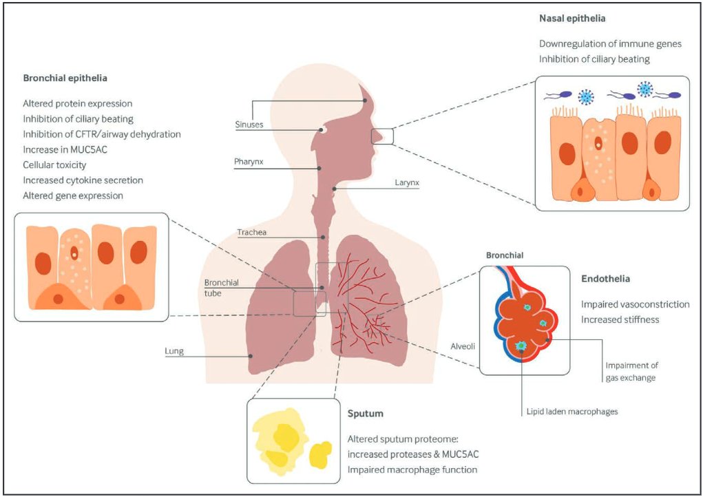 cardioteca's tweet photo. 🆕📌 Impacto cardiopulmonar de los cigarrillos electrónicos y los productos de vapeo: consenso AHA.

🔓 https://t.co/SKY6dUGVsP https://t.co/GY1GYls4aC