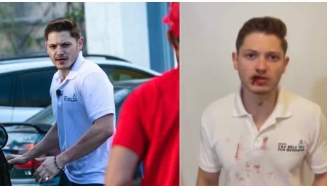 AguilarDassaev's tweet photo. Viendo estas fotografías al momento que el joven se va ¿cuando supuestamente lo golpearon entonces?
La solidaridad en los medios es selectiva. Los que hoy defienden al joven, antes se burlaron de nosotros cuando la dictadura nos amenazaba, agredia y perseguía. https://t.co/e3tfueD6n7