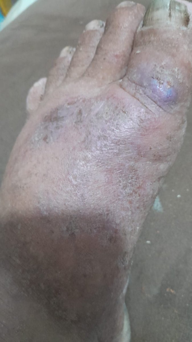 Marco Castillo tweet media