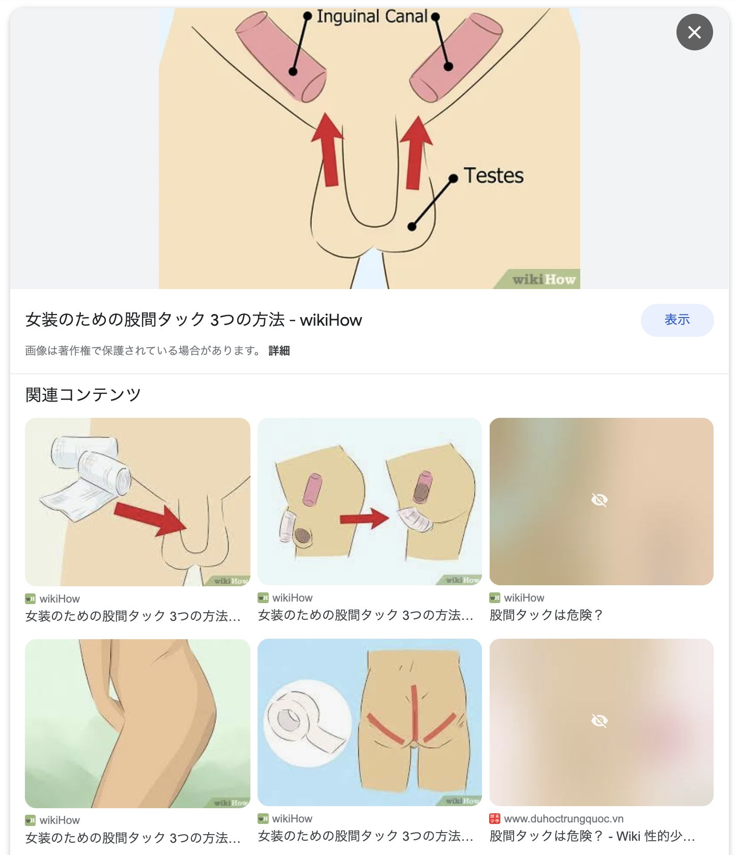 股間タック　女装　 