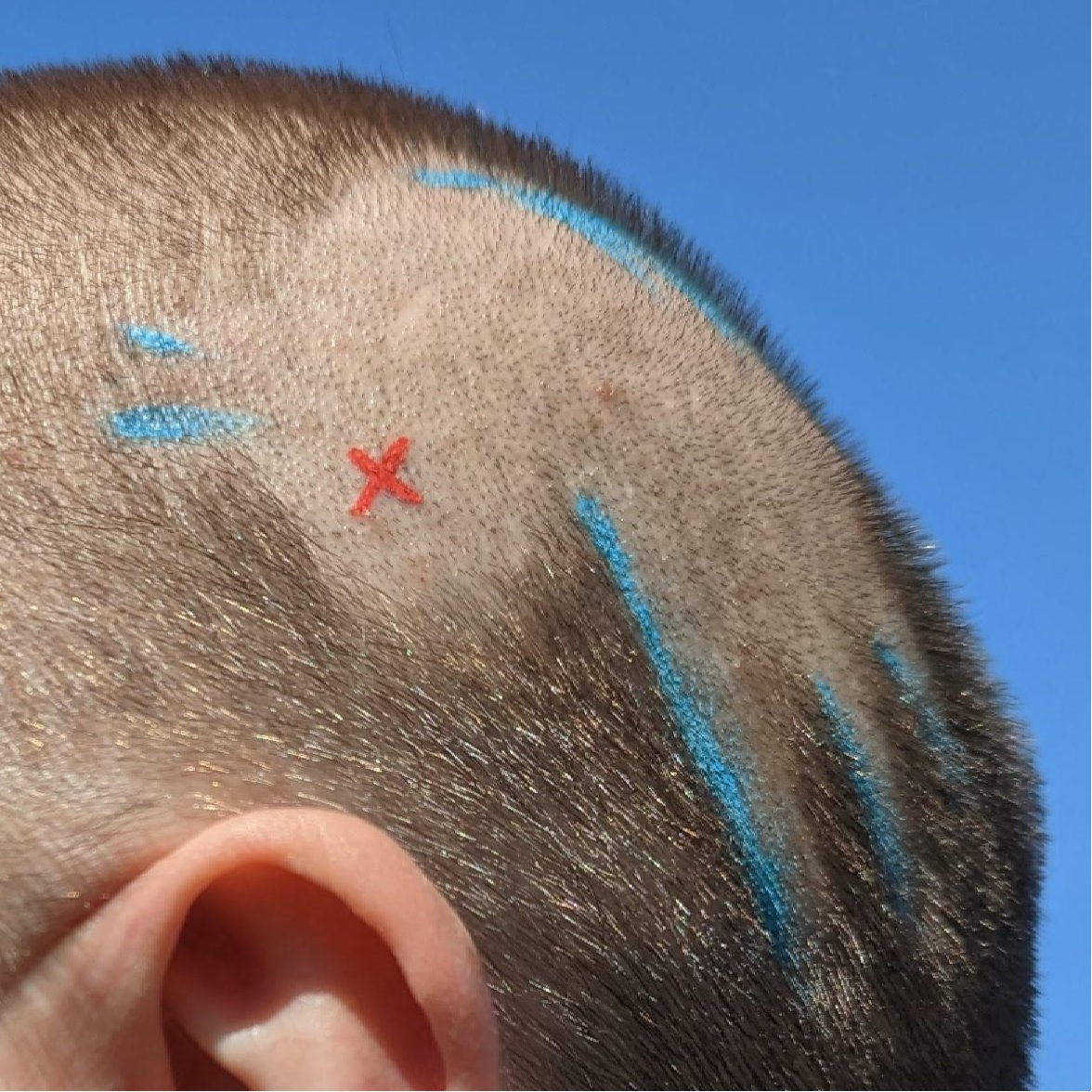 I am such a fan, that I have worn the experimental Ex-Twitter logo for some time on my head.

Full story: chaos.social/@fraunora/1104… #AbschiedVonTwitter
