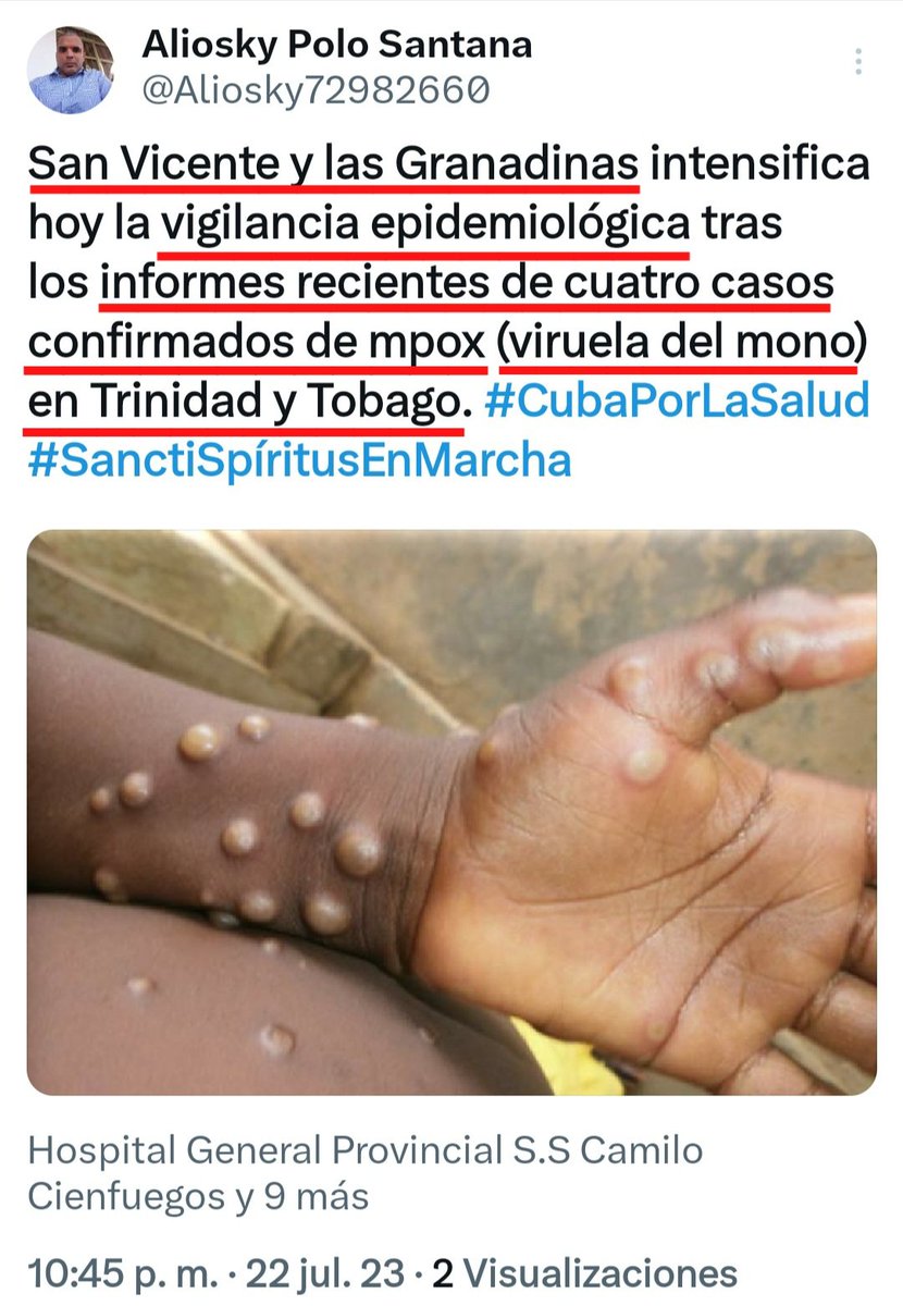 🆘️¡ALERTA!!
PRESUNTAMENTE: La llamada 'Viruela del Mono' está en nuestra hermana vecina Trinidad y Tobago
.@MinSaludVE
.@MagaGutierrezV
.@WHO
.@opsoms
.@OPSOMSVenezuela
.@GPintoVzla
.@gobersucre
.@FUNDASALUDSUCR1
.@gnbdevenezuela
.@GNB_PUEBLO
.@REDI_ORIENTAL
.@ZODI_Sucre53