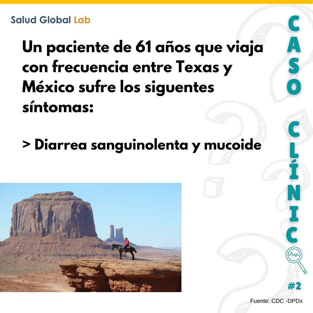 🔬 Eres capaz de resolver este caso clínico? 🧐
#pathology #retodiario #dalychallenge #aprender #domingo #retodominguero #sundaychallenge #casodedomingo #sundaycase