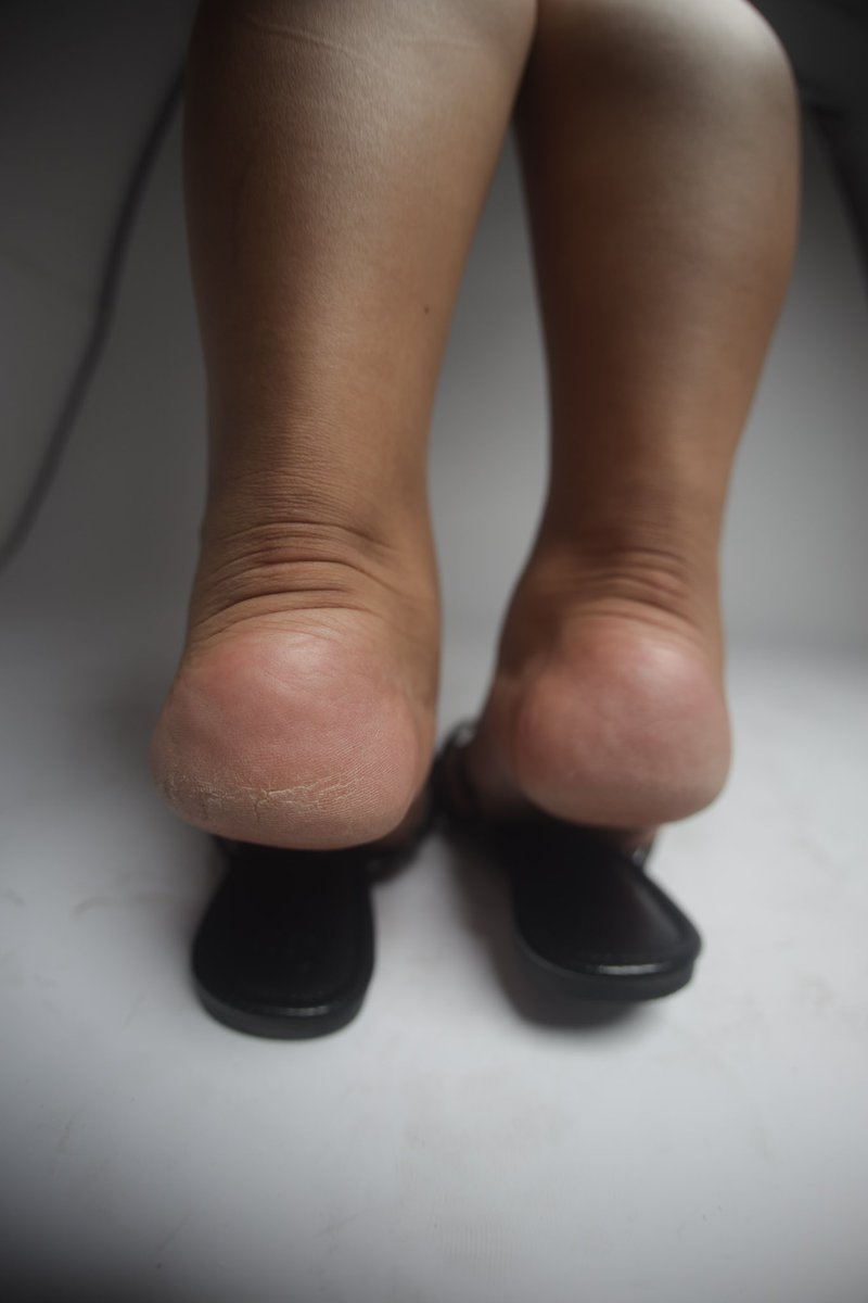 Mrloveoffeet's tweet photo. “My Soles are so thick and dry it’s hard to get these damn sandals off”
- B😮‍💨

👁️Don’t Miss‼️📸
Dm4Sets! 
#widesoles #thicksoles #bbwsoles #meatysoles #asianfeet #asiansoles #philippinofeet #cutesoles #cutefeet #prettyfeet #bigfeetgirls #臟腳 #脏脚 #臭腳 #戀足癖 #sz10 https://t.co/sDkZqj69nQ