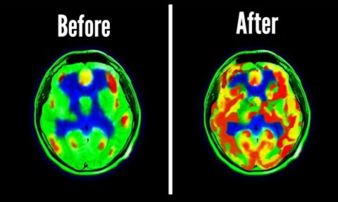 RT @MHalfknight: Dopamine Detox; How to reset your brain for success in 7 days.
(Backed by science) https://t.co/Lb0OK969zK