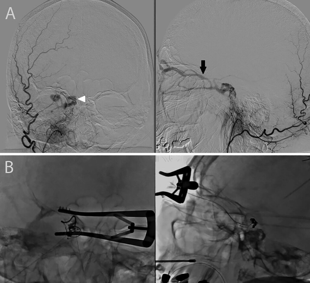 Elad Levy tweet media