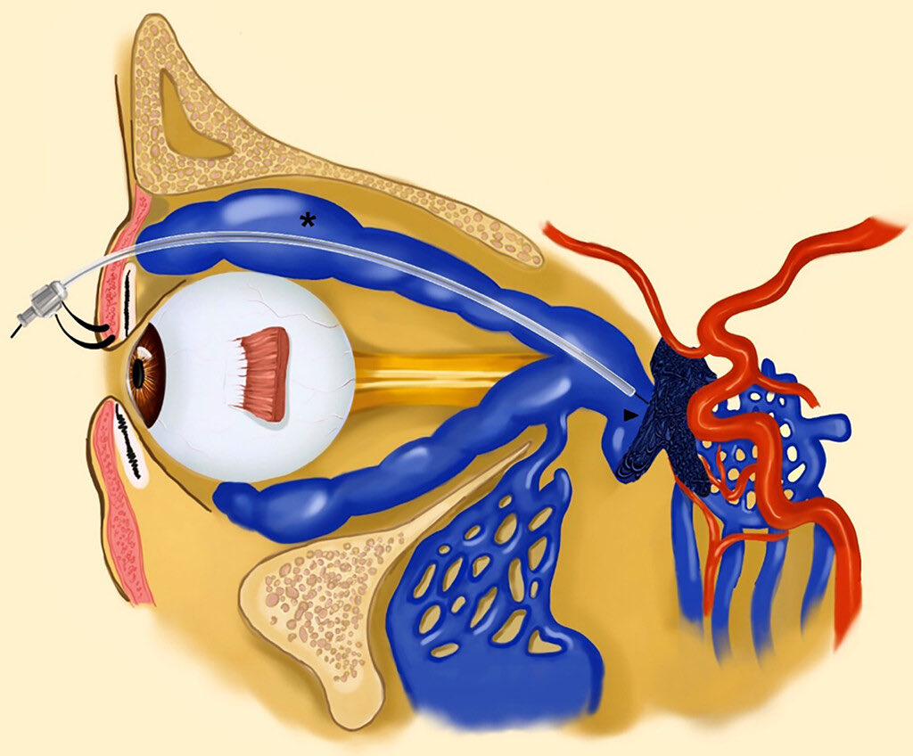 Elad Levy tweet media