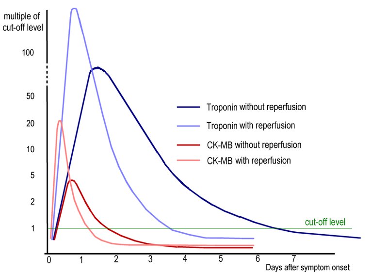 Normal Trop 🫀🩸Cardiac biomarkers of myocardial injury : 🔹 Myoglobin 🔹 CK-MB 🔹 CK 🔹 ...