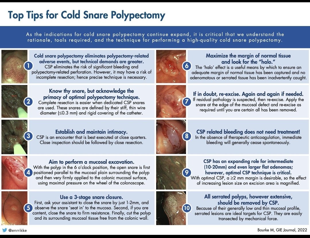 Top tips for Cold snare Polypectomy.  Excellent concise summary.
@GIE_Journal 
#Gastrotwitter 
#MedTwitter