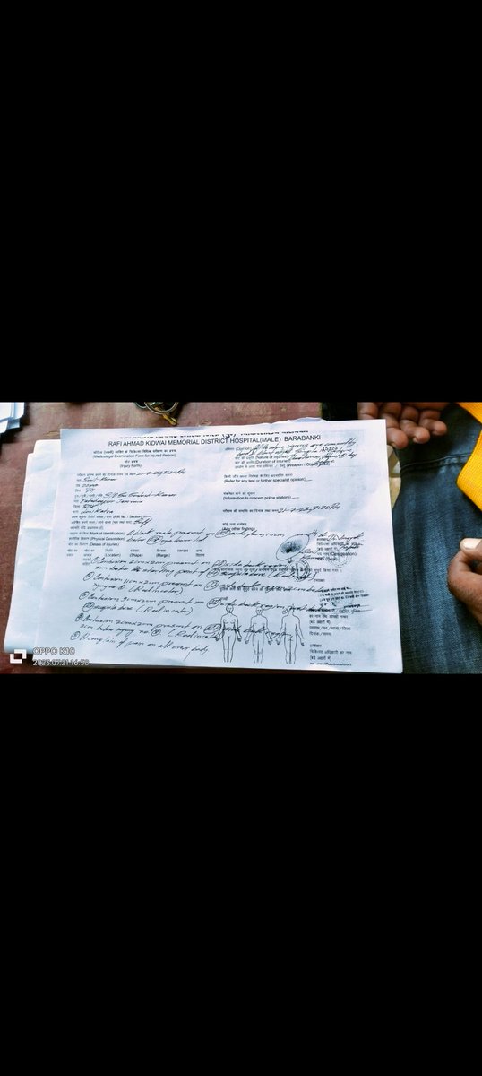 ₹25 हजार के साथ हुई मोटरसाइकिल की लूट घटना के 3 दिन बीत जाने के बाद भी नहीं हुई कार्यवाही मामला लोनी कटरा थाना क्षेत्र के फतेहपुर जमरवा का है<a href="/barabankipolice/">Barabanki Police</a> <a href="/Uppolice/">UP POLICE</a> <a href="/igrangeayodhya/">DIG Range Ayodhya</a> <a href="/myogiadityanath/">Yogi Adityanath</a>