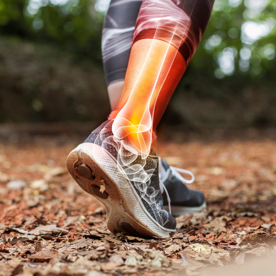 PhysioFirstC's tweet photo. Ankle pain is usually caused by common injuries like sprains, or medical conditions like arthritis, gout, or nerve damage. Symptoms can include stiffness, swelling and bruising.  

Here are some easy-to-follow exercises by Versus Arthritis: https://t.co/tYjX0rz6hu 

#anklepain https://t.co/h68E7M3k13