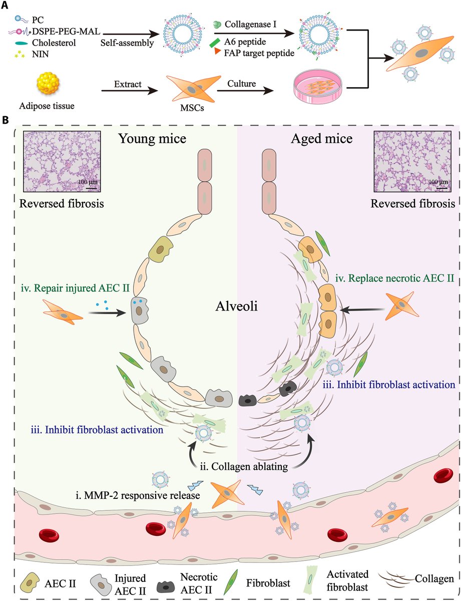 MesenchymalCell's tweet photo. A team at the China Pharmaceutical University constructed a MSC–based nanoengineered platform via the bioconjugation of MSCs and type I collagenase–modified liposomes loaded with nintedanib for treating severe #PulmonaryFibrosis.
https://t.co/qdyvSwtLbK https://t.co/WDTZxNs8IP