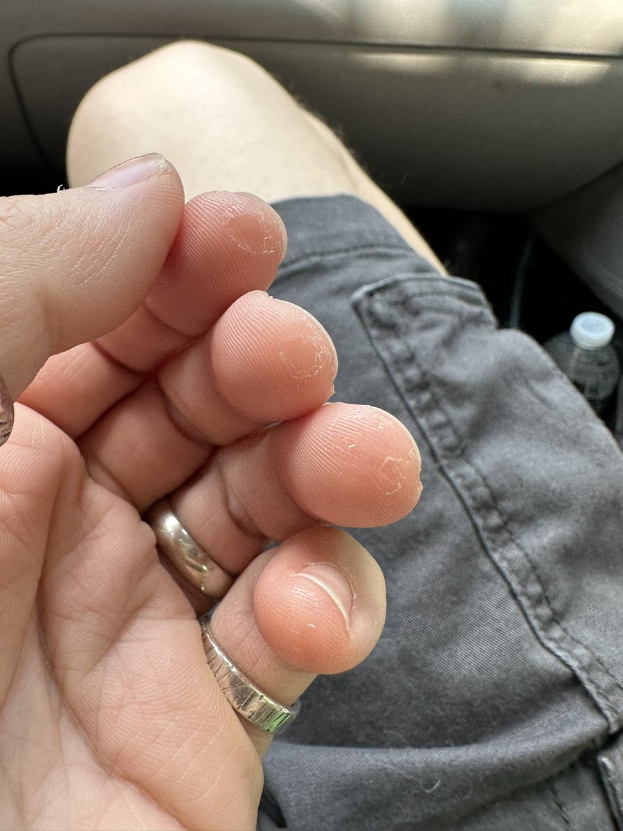 jpennwiggins's tweet photo. Learning guitar like “What fingertips?”
😅💀 https://t.co/dEyZ8EACJ0