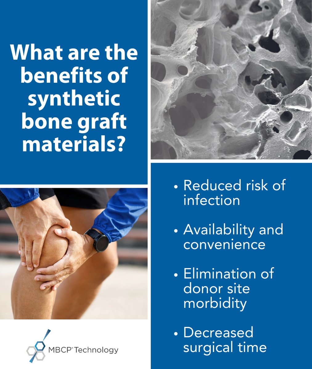What are the benefits of synthetic bone graft material in surgery?

Synthetic bone grafts are increasingly popular as a safe and reliable way to heal bones tissue. 

For more information, stay tuned for our next post!

#syntheticbonegraft #bonegrafts #bonehealing