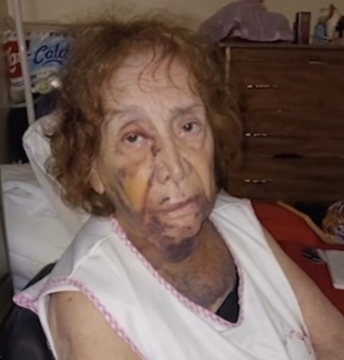 East Los Angeles Resident, Angelica Fieros a 84 year old elderly woman comes forward and says she was also attacked and brut*lly beaten by Sergio Andrew Garcia who is also responsible for brut*lly be*ting another East LA woman. https://t.co/Yt7UsANlr2