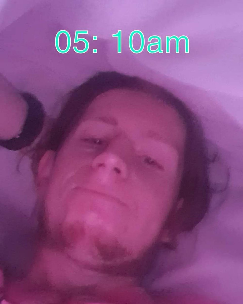 EoinDonovan11's tweet photo. 6 months to the day since I self harmed myself for the second time... just a reminder to anyone struggling at the moment, there's always light at the end of the tunnel. Day by day, I'm slowly improving mentally π π.
Depression never leaves, but you learn how to deal with it. https://t.co/6sPVW6IHtd