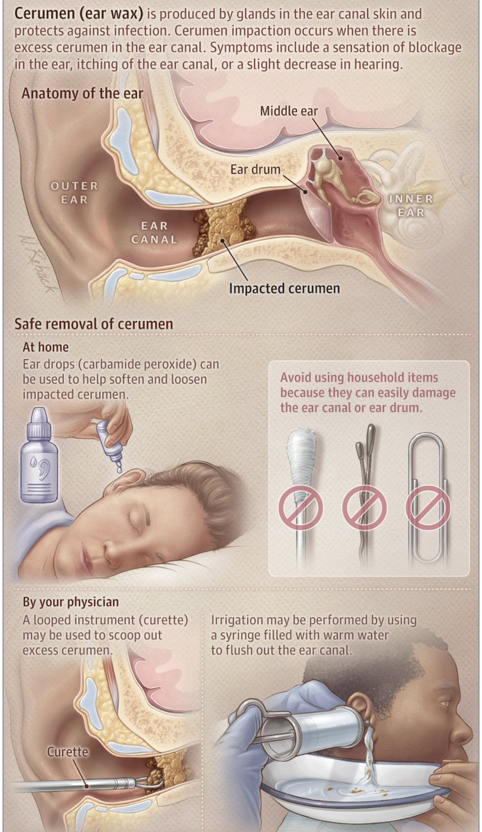 Nick Reback received a second Award of Excellence for this illustration for the @JAMAOto Patient Page published 2/24/22 “Understanding Ear Wax (Cerumen) and Ear Cleanings” by Dr James G Naples jamanetwork.com/journals/jamao…