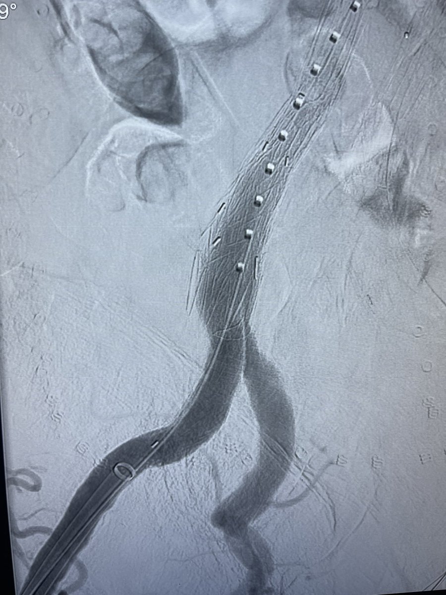 AndrewBarleben's tweet photo. @Toursavadkohi Know the drill. Call this weekend.  #aortaed https://t.co/dzEbn2dGOd