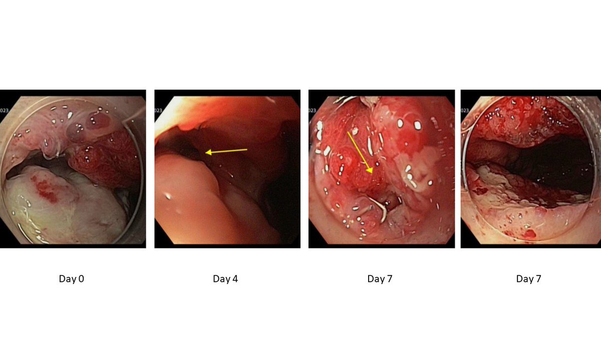 Brisbane Endoscopy tweet media