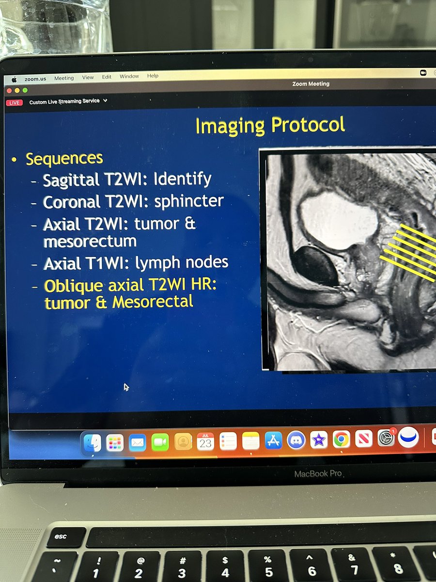 Tonight’s @CRSVirtualEd lecture on Rectal Cancer MRI by Dr. Ashish Wasnik from @UMich was absolutely PURE GOLD!!! Thanks sir!!