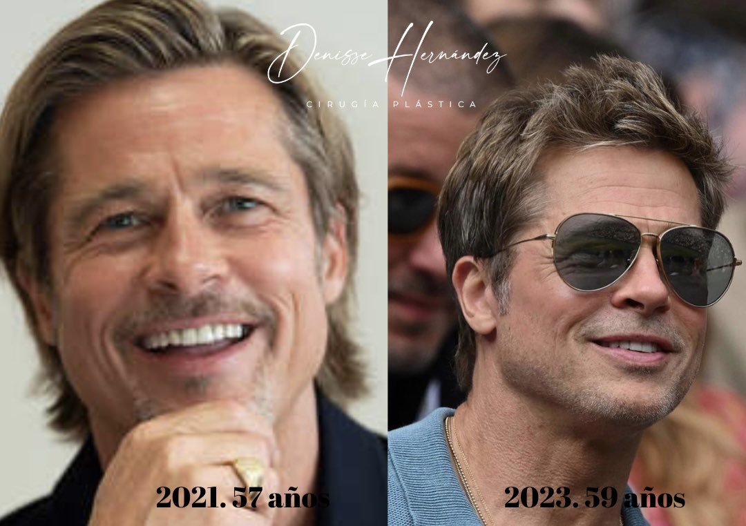Dradenhdez's tweet photo. ¿Cuando creen que se ve mejor #Bradpitt?
¿Antes o Ahora? A sus casi 60 años 😍♥️
#antesydespues #cirugiaplastica https://t.co/ohaE3d7d9O