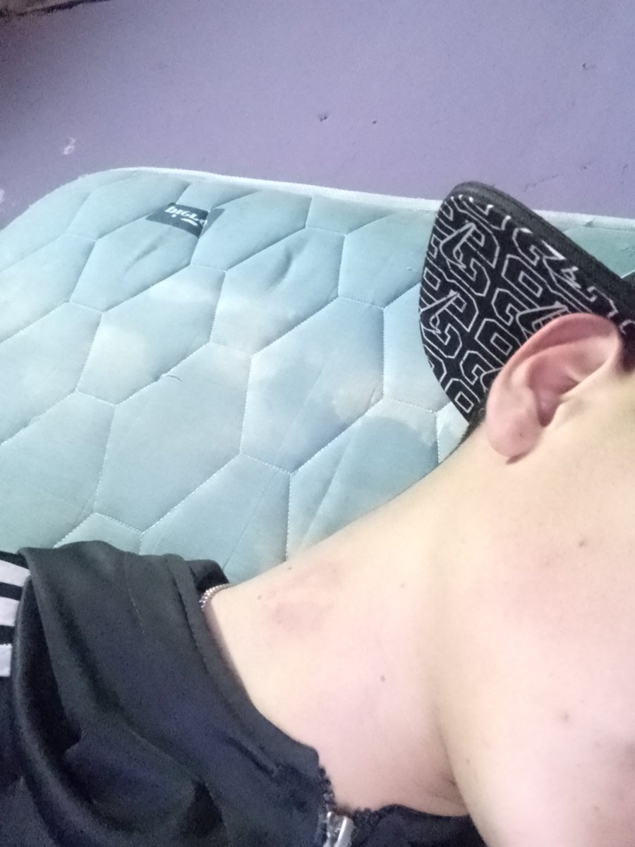 Guarda con los mosquitos que andan re picantes😅✌🏻