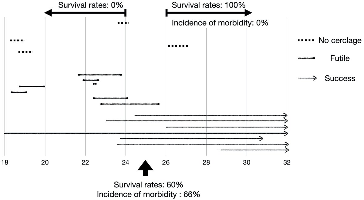CEOGjournal's tweet photo. Rescue Cervical Cerclage for Protruding Amniotic Sac: A Retrospective Analysis of Clinical Efficacy
has been published in @CEOGjournal at https://t.co/nx9lWTcWqu
Welcome to your reading!
#cervical_insufficiency
#McDonald_cerclage
#perinatal_outcome
#rescue_cerclage
#tocolysis https://t.co/71tpULrT38