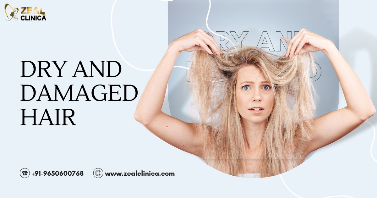 Say goodbye 👋 to dry and #DamagedHair with our revolutionary treatment at #ZealClinica!💆‍✨ Restore, revitalize, and reclaim your luscious locks with our expert care and premium products.

#dryhair #dryhairsolution #damagedhaircare #hairloss #hairfall #haircare #hairgoals #hair