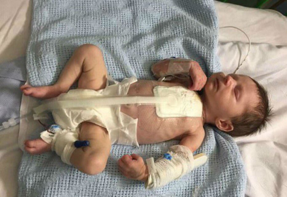 Αν το παιδί σας,το εγγόνι σας γεννιόταν με καρδιοπάθεια και χρειαζόταν χειρουργική επέμβαση τους πρώτους μήνες της ζωής του, ξαφνικά θα κατανοούσατε ότι η πλήρης και απρόσκοπτη λειτουργία του παιδοκαρδιοχειρουργικού κέντρου στο #ΠαιδωνΑγιαΣοφια24 είναι ζήτημα ζωής.
<a href="/chrisochoidis/">Μιχάλης Χρυσοχοΐδης</a>