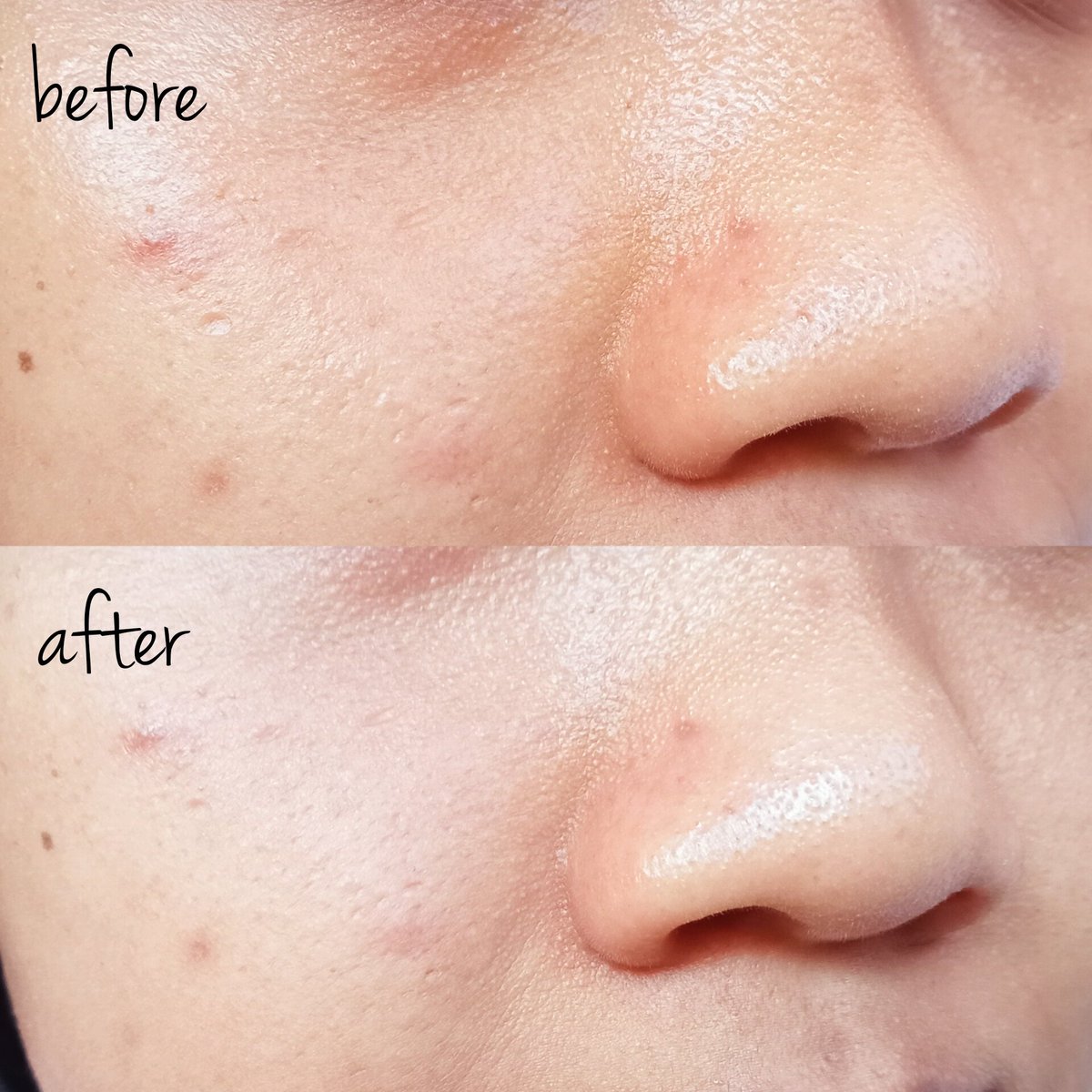 update night skincare routine akuu pake dua produk dari <a href="/EveroseBeauty/">Everose Beauty</a>
 
•invisipeel soft peel &amp; lightening night cream•

kulit kusem siniii simakk review nyaa~

#racuninskincare #reviewbymatcha