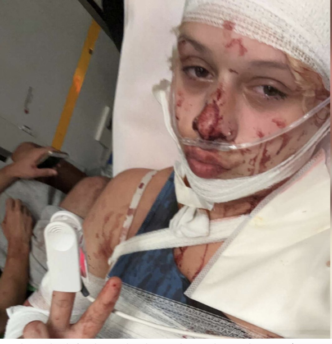 Allahu Akbar: Sharia Police Strike Again in France: Young Woman Brutally Attacked Over Clothing 

A 19-year-old woman was stabbed with shards of bottles 50 times in France by North African [Islam is the main religion] migrants. The 19-year-old victim, Nissan, will be disfigured