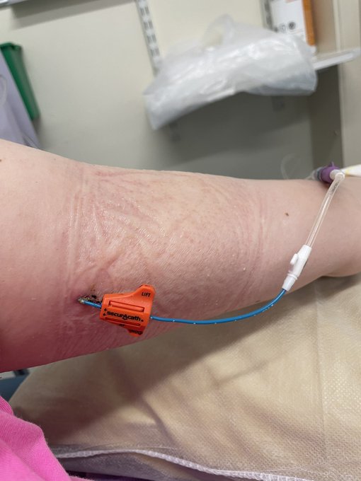 Having my PICC line cleaned before chemo!! 😣 https://t.co/3X2yFJCQjc<a href="/tag/findom"class="tags"><span>#findom</span></a><a href="/tag/cuckoldhubby"class="tags"><span>#cuckoldhubby</span></a><a href="/tag/onlyfansgirl"class="tags"><span>#onlyfansgirl</span></a><a href="/tag/alphadominant"class="tags"><span>#alphadominant</span></a>