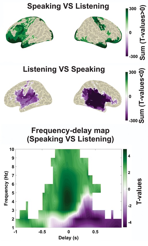 PLOSBiology's tweet photo. .@Omid__Abbasi @Joachim__Gross &amp;co investigate the neural dynamics involved in #SpeechProduction &amp; perception, offering valuable insights into the complex processing mechanisms that drive these cognitive processes #PLOSBiology https://t.co/Fk9BagfwgF https://t.co/AmHc2PVLU2
