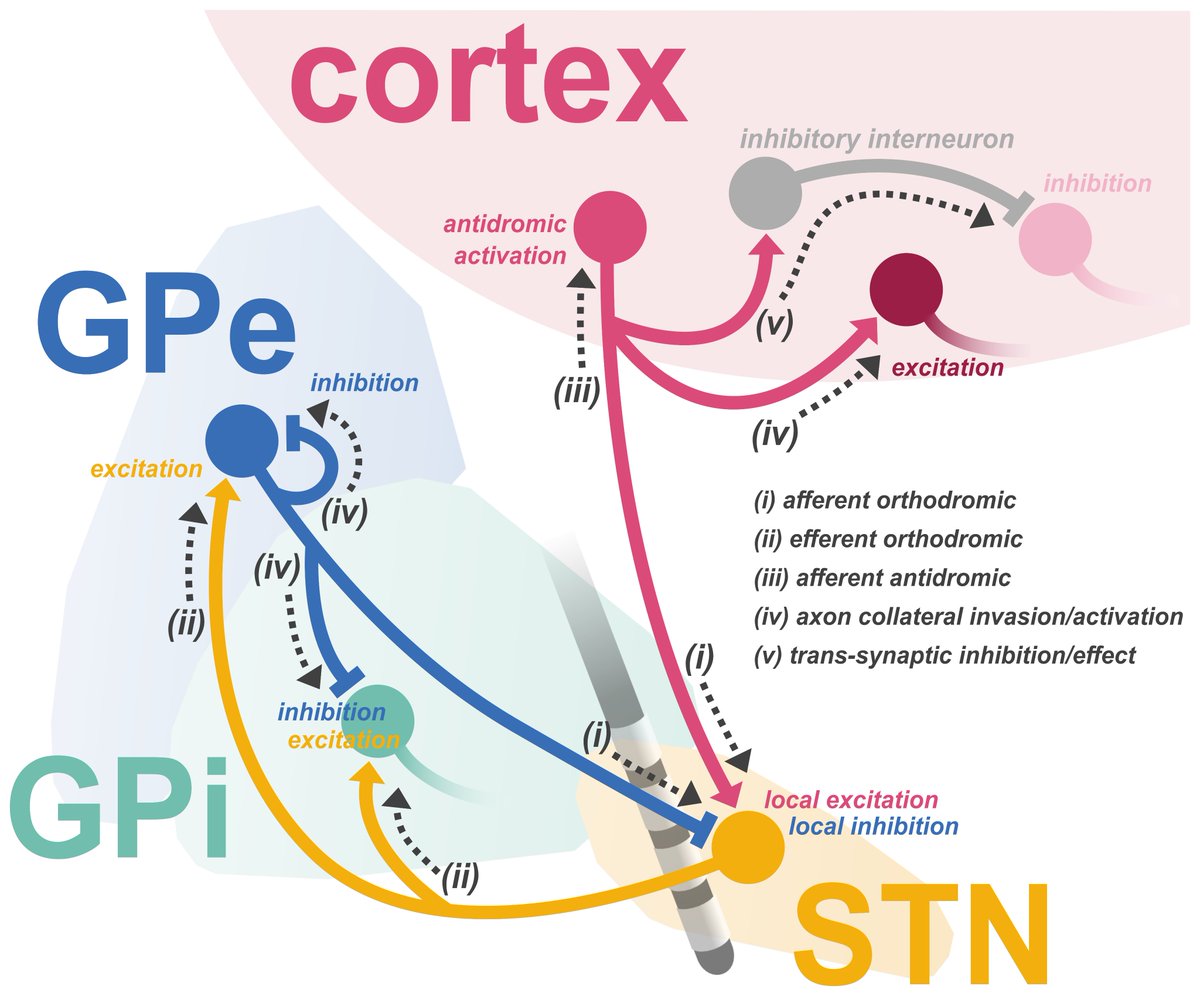 Brain1878's tweet photo. How does deep brain stimulation work? Neumann et al. provide a critical review of competing theories of the underlying mechanisms of action. https://t.co/lR5tnFRda7 https://t.co/VwM6aCMkdj