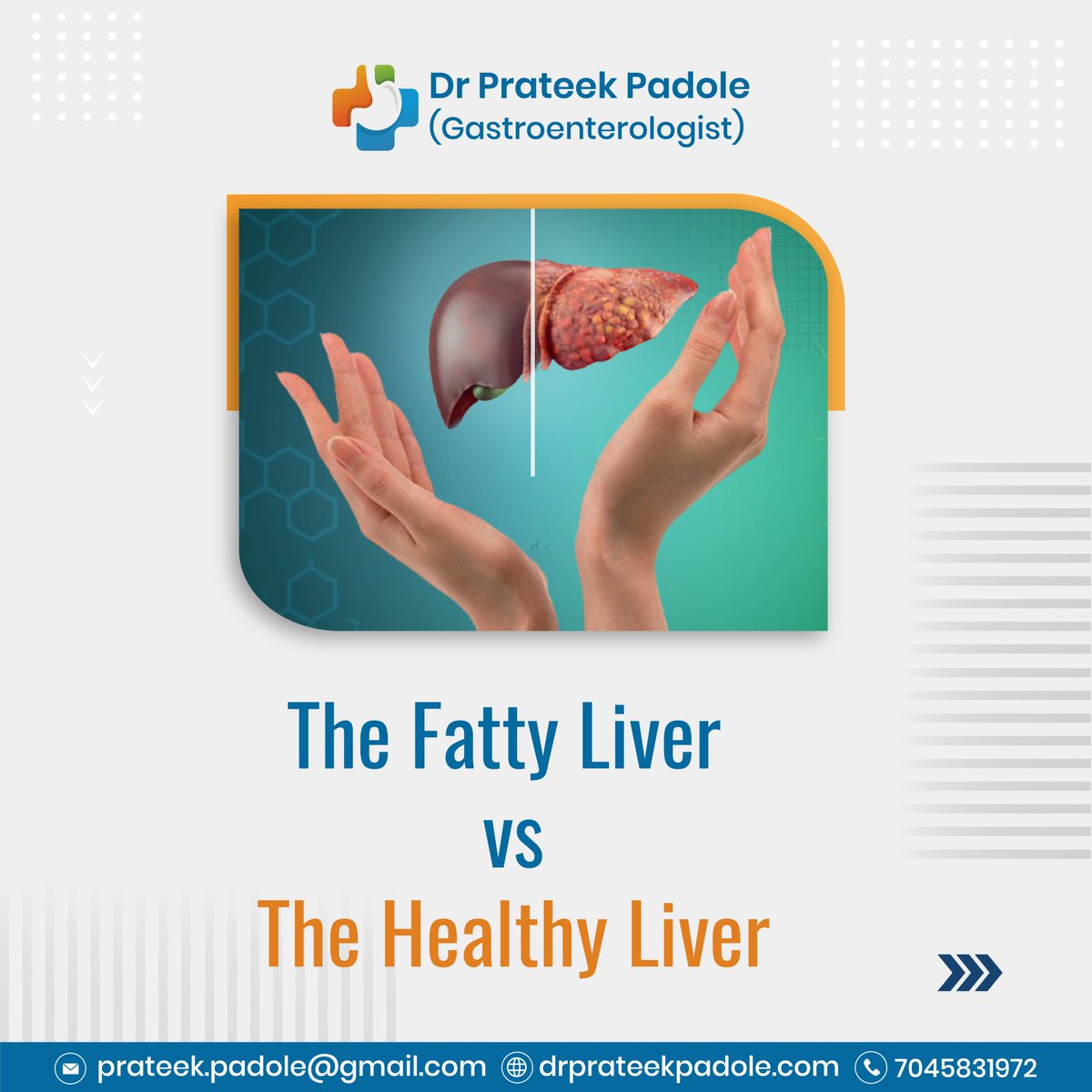 DrprateekP's tweet photo. The Fatty Liver vs The Healthy Liver

#gastroenterologistinnagpur #abdomenspecialistinnagpur 
#gastroenterologistinsadar #gastroenterologistinramdaspeth
#stomachdoctorinsadarnagpur #abdominalexpert #gastroenterology #gastroenterologist #gastroproblems #drprateekpadole https://t.co/x64VtvCshF