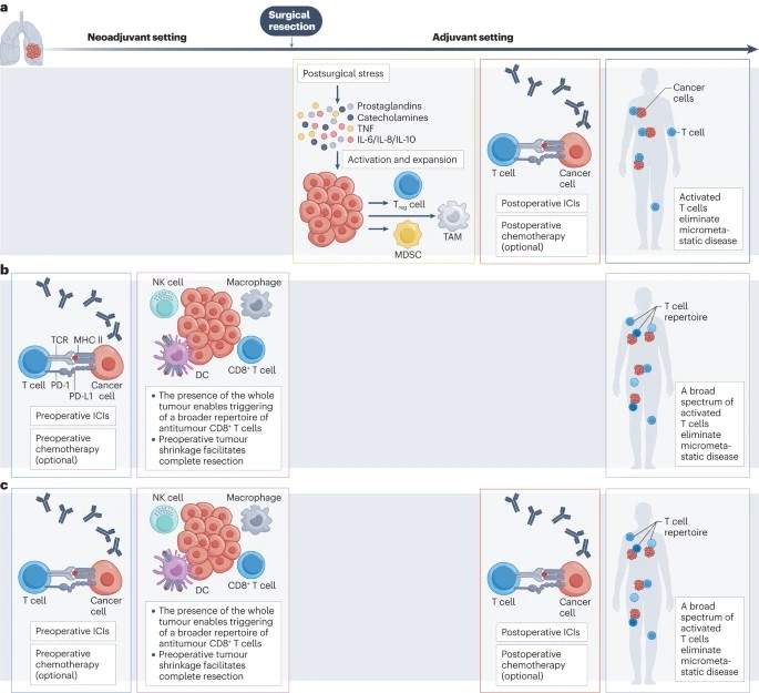 NatRevClinOncol's tweet photo. In a Review now online, @g_mountzios @JordiRemon @HendriksLizza Rosario García-Campelo @ChristianRolfo Paul Van Schil @FordePatrick @BenjaminBesseMD @VivekSubbiah @MartinReck2 @jsoriamd @peters_solange comprehensively review perioperative ICIs #lungcancer https://t.co/TOmYw2q51C https://t.co/QquTXpW9Hm