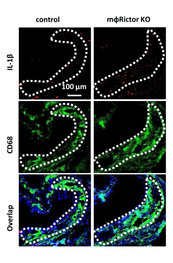 Zhang et al reveal the atheroprotective role of #macrophage #mTORC2 signaling via #FoxO1-mediated stimulation of #IL1β transcription. Learn about its role in #atherosclerosis at ahajrnls.org/43F64le      
<a href="/XiangyuZ0321/">Xiangyu Zhang</a> <a href="/RazaniLab/">Babak Razani, MD, PhD Laboratory</a> <a href="/Art_Yurdagul/">Art Yurdagul</a> <a href="/Astrid_C_RV/">Astrid C. Rodríguez-Vélez</a> <a href="/tdevans27/">trent evans</a>
