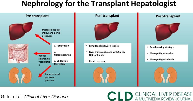 Liver/Intestinal Community of Practice - AST (@ast_licop) on Twitter photo 🚨AST LICOP #ManuscriptMonday🚨
#Nephrology for the #transplant hepatologist in <a href="/CLD_Learning/">ClinicalLiverDisease</a>
by <a href="/ZGitto/">Zachary Gitto</a>, Pranab Barman & <a href="/ShravanDave10/">Shravan Dave</a> of <a href="/UCSD_GI/">UCSD Gastroenterology</a>
journals.lww.com/cld/Fulltext/9…
#liverwitter #transplantation 🚨AST LICOP #ManuscriptMonday🚨
#Nephrology for the #transplant hepatologist in <a href="/CLD_Learning/">ClinicalLiverDisease</a>
by <a href="/ZGitto/">Zachary Gitto</a>, Pranab Barman & <a href="/ShravanDave10/">Shravan Dave</a> of <a href="/UCSD_GI/">UCSD Gastroenterology</a>
journals.lww.com/cld/Fulltext/9…
#liverwitter #transplantation