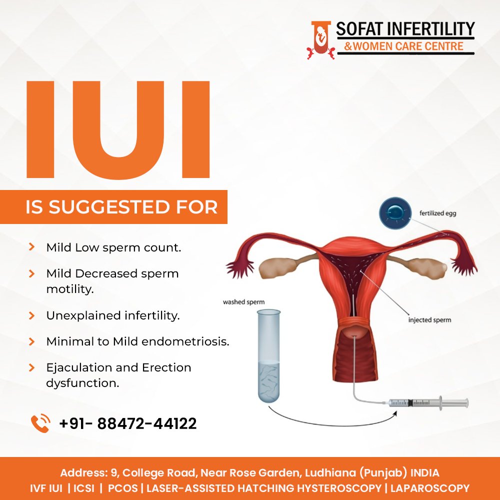 IUI IS SUGGESTED FOR
> Mild Low sperm count.
> Mild Decreased sperm motility.

Consult our expert today
☎️:- +91-88472-44122
🌐:- sofatinfertility.com

#maleinfertility #lowspermcount #fertilitysupport #iuihope #conceptionassistance #fertilitytreatment #iuijourney #ludhiana