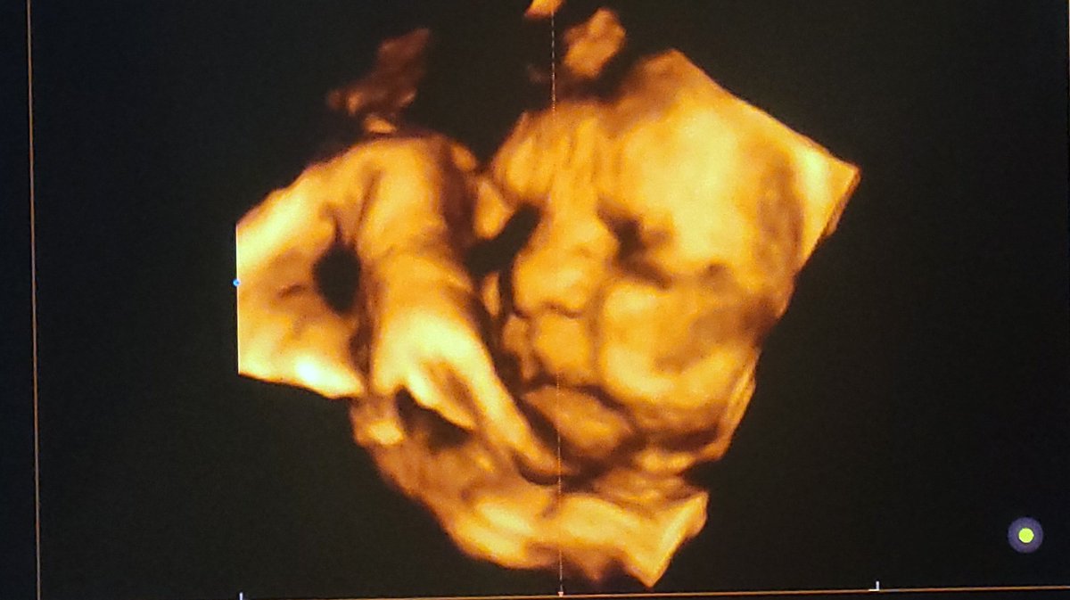 AlejandraCruz64's tweet photo. Cada Vez Estamos Más Cerca De Conocerle ❤️🤱 https://t.co/WphajYtATX