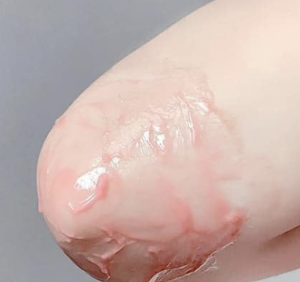 itssssssssara's tweet photo. 5. Apply peeling solution dekat lipatan-lipatan hitam. Teknik ni best sebab lutut, siku semua boleh! Jadi makin cerah ✨

https://t.co/61YNqx4Wdw https://t.co/Lr2zT85vqe