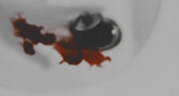 TW : บรรยายถึงบาดแผล และ เลือก

— งานภาคสนามลากยาวมาจนบ่าย 
ไม่วายมีเรื่องทะเลาะวิวาทกับคนในทีมอีก

ทันทีที่ความวุ่นวายและภารกิจจบลง สาวเจ้าก็ปลีกตัวออกมาจากทุกอย่าง

หลบหายไปในห้องน้ำในฐานที่ใกล้ตัวถกแขนเสื้อชุดขึ้นจนพบแผลทางยาวที่ถูกพันกดไว้ลวกๆและในตอนนี้เลือดกำลังหยดลงอ่าง

+