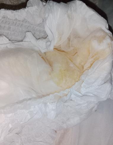 bedwetting_ano's tweet photo. Le résultat de cette nuit.... J'ai encore fais pipi au lit... comme un bébé ! 💧#diapers #pee #bedwetting #omorashi #piss #wet #wetting #baby https://t.co/jV1lRNpMCw