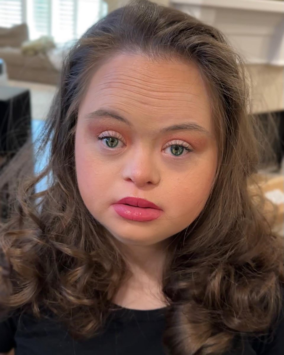 Those eyes❤️ #downsyndrome #NaturalBeauty