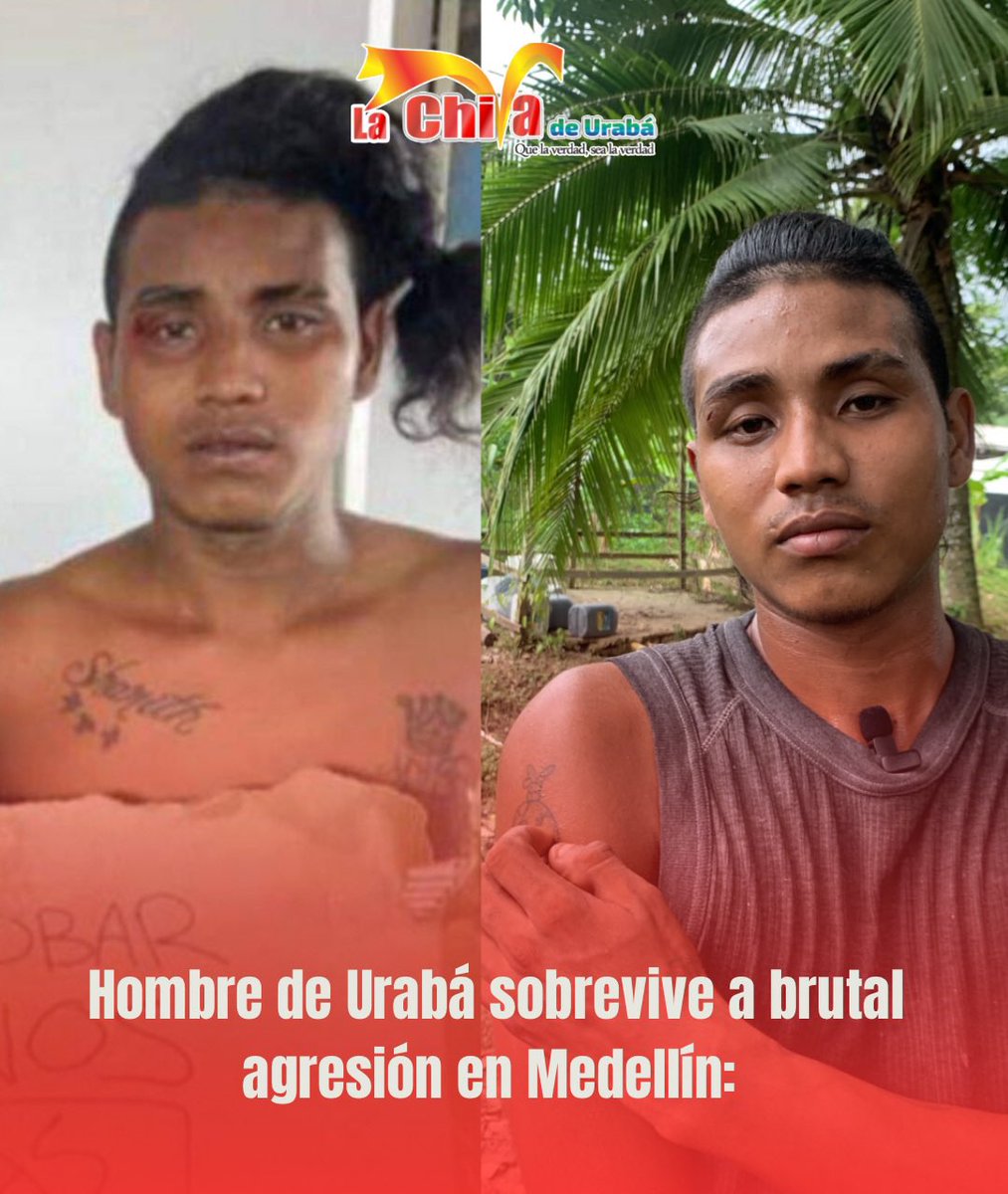 EdwardFAlvarez's tweet photo. Franklin Mosquera, un habitante de Apartadó, relató que un milagro lo tiene vivo, le después de ser agredido físicamente por varios sujetos del barrio Manrique de Medellín. https://t.co/eqZwik9Itj