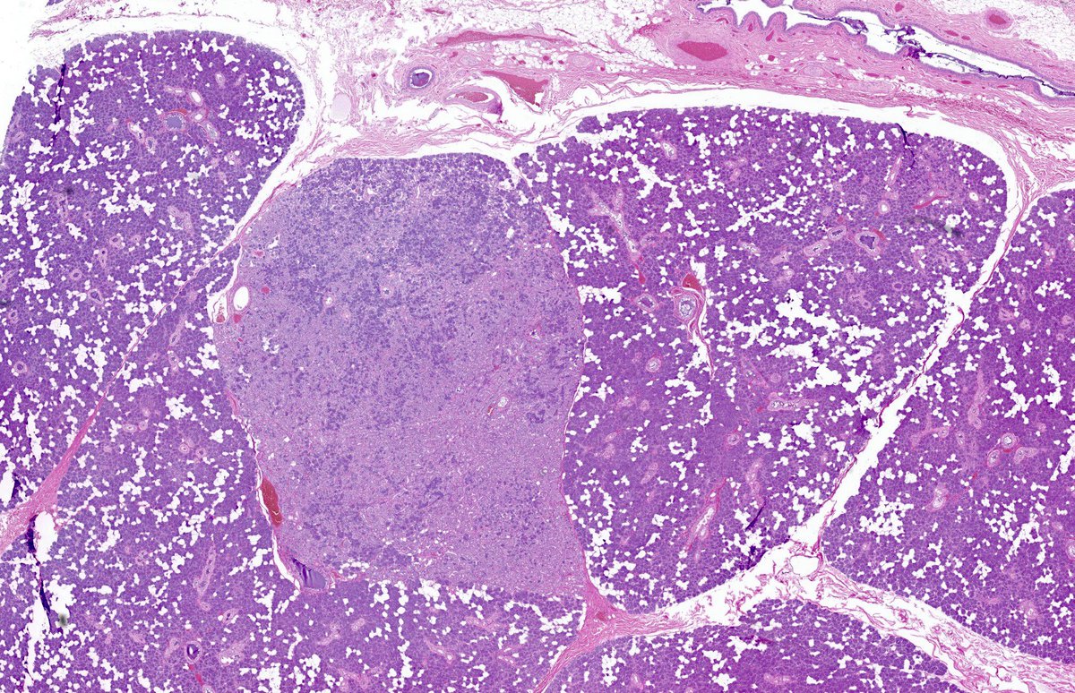 North American Society of Head & Neck Pathology tweet media